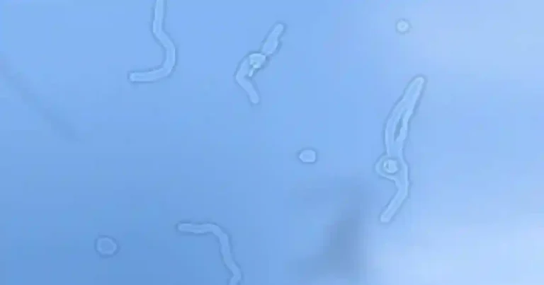 🐛Weird Because Sometime Dust Appear As Insect to us 🐛
